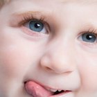 Labios agrietados en un niño pequeño
