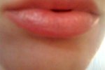 How to Heal Sun Poisoning on Your Lips (with Pictures) | eHow