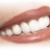 Clean dental implants regularly