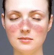 What Are the Causes of Face Rash?