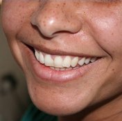 Home Remedy For Inflamed Gums