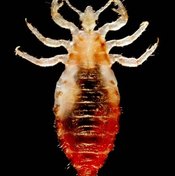 Image of Head Lice