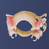 Some dentures are made using only acrylic, which helps them blend in with the surrounding mouth.