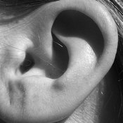 Earwax buildup can reduce hearing ability.