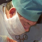 Brain aneurysm surgery involves clipping off the aneurysm.