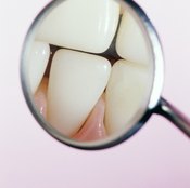 Tooth enamel is the visible part of your teeth.