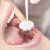dentist looking inside woman's mouth for fungus