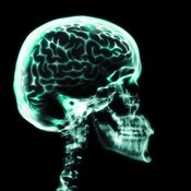 X-ray of the brain and skull