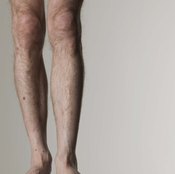 Very skinny legs might not look healthy.