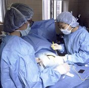 A C-section is considered major surgery.