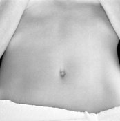 Sculpting an innie belly button is a matter of cosmetic surgery.