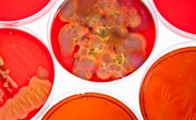 How Are Bacteria & Plant Cells Alike?