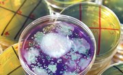 How to Count Colonies in Microbiology