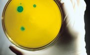 The Best Ways to Grow Bacteria on Agar