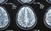 Specialties of the Right Side of the Brain