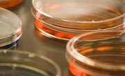 How to Make Nutrient Agar for Petri Dishes