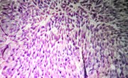 List Three Methods That Can Modify Bacteria Genetically