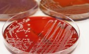 How Do Bacteria Reproduce?