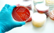 What Are Agar Slants?