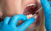 Good News! Tooth Regeneration Could Replace Fillings