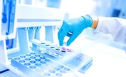 Difference Between Transcription and DNA Replication
