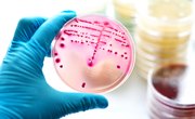 What Three Conditions Are Ideal for Bacteria to Grow?