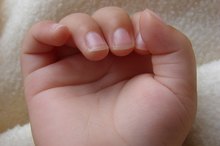 什么导致指甲中的水平脊？
