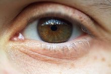眼睑变色的原因是什么?