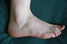 The Best Treatment for Peripheral Neuropathy in Feet