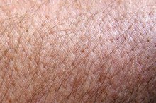 Cortisol Levels & Itchy Skin