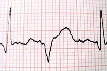 EKG机器的四个部分是什么？