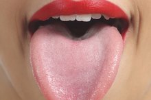 Black Tongue Symptoms