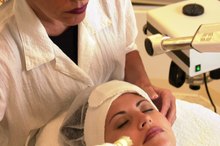 Microdermabrasion for Legs