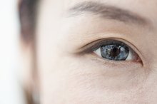 What Causes Edema Above the Eyes?