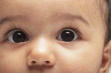 Adverse Effects of Gentamicin Eye Drops on Babies