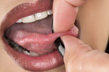 舌环感染的迹象和症状
