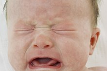 婴儿脸上的斑疹