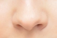 Complications of Nasal Polyp Surgery