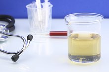 What Drugs Are Tested for in a Urinalysis?