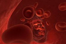 How to Lower Hemoglobin