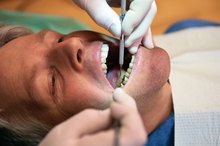 Dental Bridge Complications