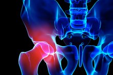 Causes of Pain in the Hip and Groin Area