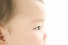 如何在一个2个月大的婴儿中检测眼问题