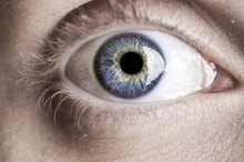 How to Reverse Cataracts With Nutrition