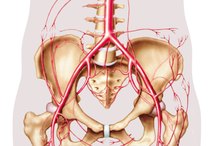 What Are the Signs and Symptoms of Dissecting Iliac Artery Aneurysm?