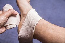 How to Best Help a Sprained Ankle