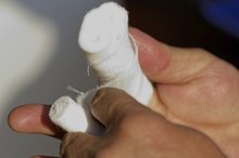 The Duration of a Broken Finger