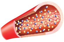 What Are the Sources of LDL & HDL Cholesterol?