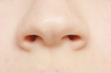 Dry Flaky Skin Around Nose & Corners of Mouth
