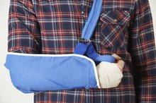Types of Physical Therapy for a Broken Arm